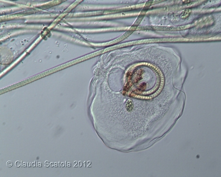 Thecamoeba verrucosa